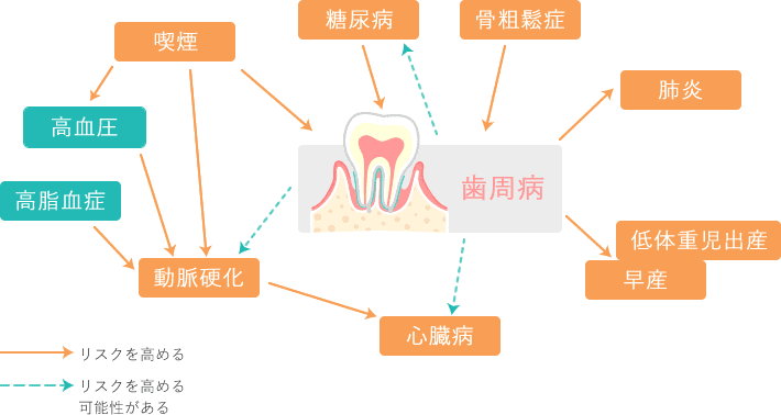 歯周病の予防とケアイメージ画像